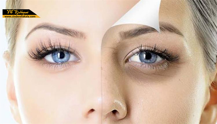 استفاده از صابون های سیندرلا برای روشن شدن پوست و رفع تیرگی دور چشم