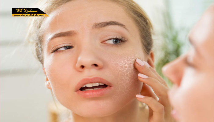دلایل خشکی پوست در فصل تابستان و نحوه درمان آن